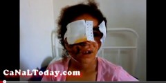الطفلة وئام تعرضت لمحاولة إغتصاب وإعتداء بالمنجل وعلى وجهها حوالي 50 غرزة