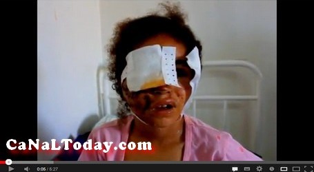 الطفلة وئام تعرضت لمحاولة إغتصاب وإعتداء بالمنجل وعلى وجهها حوالي 50 غرزة