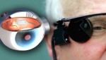 العين الإلكترونية فرصة جديدة للمصابين بالعمى !!
