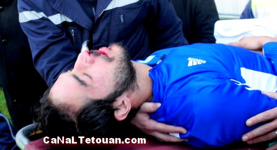 مرتضى فال يعتذر للاعب الرجاء ياسين الصالحي بعد إصابته بكسر على مستوى الأنف