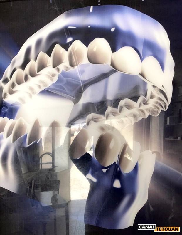 افتتاح التسجيل في معهد مرخص له من طرف الدولة خاص بترميم الأسنان بمرتيل (+ الصور)